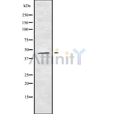 Western blot analysis of extracts from hybridoma cells, using HOXB3 Antibody. Lane 1 was treated with the blocking peptide.