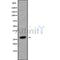 Western blot analysis of HOXB8 using LOVO whole cell lysates