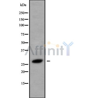 Western blot analysis of HOXB8 using LOVO whole cell lysates