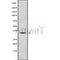 Western blot analysis of extracts from hybridoma cells, using HOXC13 Antibody. Lane 1 was treated with the blocking peptide.
