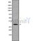 Western blot analysis of HOXC9 using COLO205 whole cell lysates