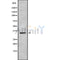Western blot analysis of HOXD11 using MCF7 whole cell lysates