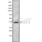 Western blot analysis of HOXD13 using COLO205 whole cell lysates