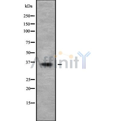 Western blot analysis of HOXD9 using HepG2 whole cell lysates