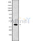 Western blot analysis NKX22 using Jurkat whole cell lysates