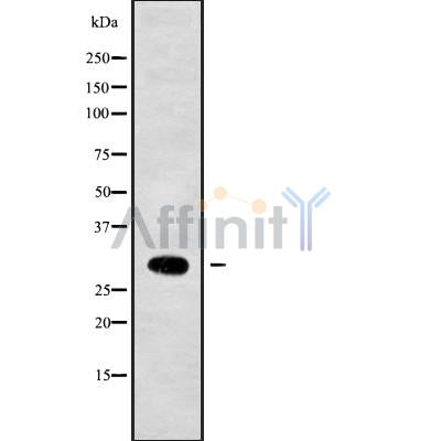Western blot analysis NKX22 using Jurkat whole cell lysates