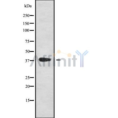 DF9589 staining CoLo by IF/ICC. The sample were fixed with PFA and permeabilized in 0.1% Triton X-100,then blocked in 10% serum for 45 minutes at 25¡ãC. The primary antibody was diluted at 1/200 and incubated with the sample for 1 hour at 37¡ãC. An  Alexa Fluor 594 conjugated goat anti-rabbit IgG (H+L) Ab, diluted at 1/600, was used as the secondary antibod