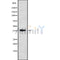 DF9589 staining CoLo by IF/ICC. The sample were fixed with PFA and permeabilized in 0.1% Triton X-100,then blocked in 10% serum for 45 minutes at 25¡ãC. The primary antibody was diluted at 1/200 and incubated with the sample for 1 hour at 37¡ãC. An  Alexa Fluor 594 conjugated goat anti-rabbit IgG (H+L) Ab, diluted at 1/600, was used as the secondary antibod