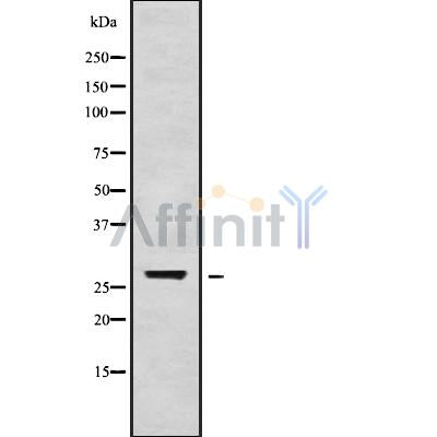 DF9593 at 1/100 staining Human lung tissue by IHC-P. The sample was formaldehyde fixed and a heat mediated antigen retrieval step in citrate buffer was performed. The sample was then blocked and incubated with the antibody for 1.5 hours at 22¡ãC. An HRP conjugated goat anti-rabbit antibody was used as the secondary