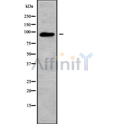 DF9596 at 1/100 staining Human brain cancer tissue by IHC-P. The sample was formaldehyde fixed and a heat mediated antigen retrieval step in citrate buffer was performed. The sample was then blocked and incubated with the antibody for 1.5 hours at 22¡ãC. An HRP conjugated goat anti-rabbit antibody was used as the secondary
