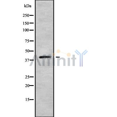DF9597 at 1/100 staining Human Head and neck cancer tissue by IHC-P. The sample was formaldehyde fixed and a heat mediated antigen retrieval step in citrate buffer was performed. The sample was then blocked and incubated with the antibody for 1.5 hours at 22¡ãC. An HRP conjugated goat anti-rabbit antibody was used as the secondary
