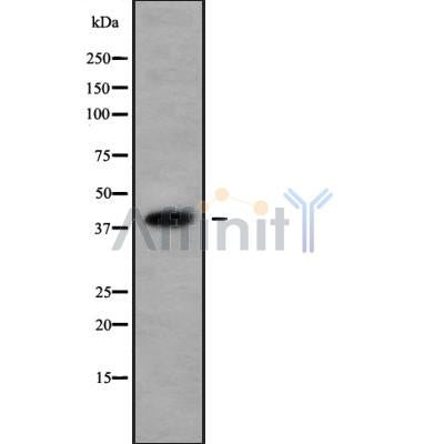 Western blot analysis of KHDRBS3 using Jurkat whole cell lysates
