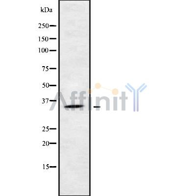 Western blot analysis of KIR2DS5 using LOVO whole cell lysates