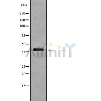 Western blot analysis of A4GALT using K562 whole cell lysates