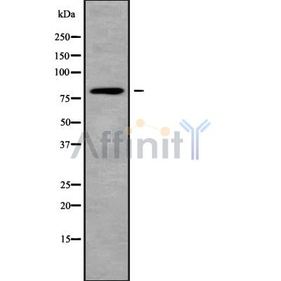 Western blot analysis of extracts from mouse muscle, using ACSL1 Antibody. Lane 1 was treated with the blocking peptide.
