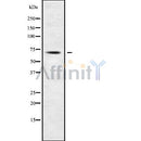 Western blot analysis of ACSL3 using Jurkat whole cell lysates