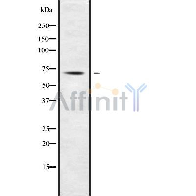 Western blot analysis of ACSL3 using Jurkat whole cell lysates