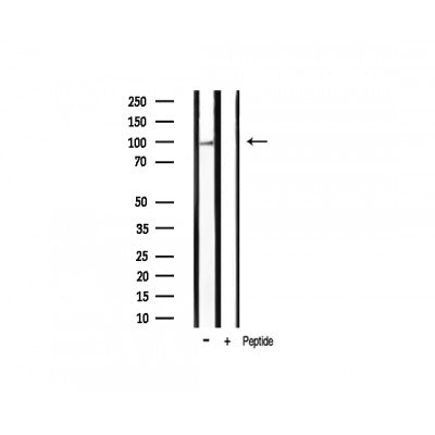 AF3126 staining HeLa cells by IF/ICC. The sample were fixed with PFA and permeabilized in 0.1% Triton X-100,then blocked in 10% serum for 45 minutes at 25¡ãC. The primary antibody was diluted at 1/200 and incubated with the sample for 1 hour at 37¡ãC. An  Alexa Fluor 594 conjugated goat anti-rabbit IgG (H+L) antibody(Cat.