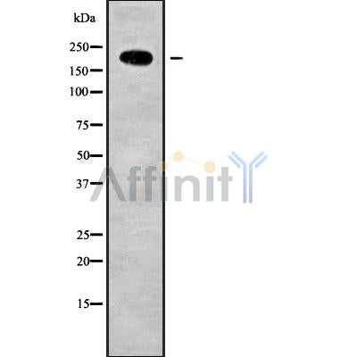Western blot analysis of extracts from 3t3, using LRP4 Antibody. The lane on the left was treated with blocking peptide.