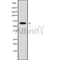 Western blot analysis of MARVELD2 using HepG2 whole cell lysates