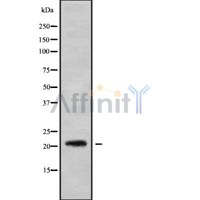 DF9614 at 1/100 staining Human kidney tissue by IHC-P. The sample was formaldehyde fixed and a heat mediated antigen retrieval step in citrate buffer was performed. The sample was then blocked and incubated with the antibody for 1.5 hours at 22¡ãC. An HRP conjugated goat anti-rabbit antibody was used as the secondary