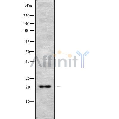 DF9615 at 1/100 staining Mouse liver tissue by IHC-P. The sample was formaldehyde fixed and a heat mediated antigen retrieval step in citrate buffer was performed. The sample was then blocked and incubated with the antibody for 1.5 hours at 22¡ãC. An HRP conjugated goat anti-rabbit antibody was used as the secondary
