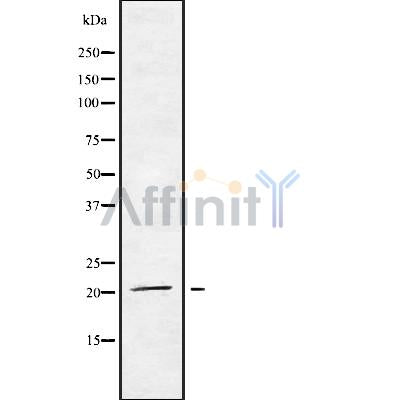 Western blot analysis of extracts from Mouse brain, using MED29 Antibody. The lane on the left was treated with blocking peptide.