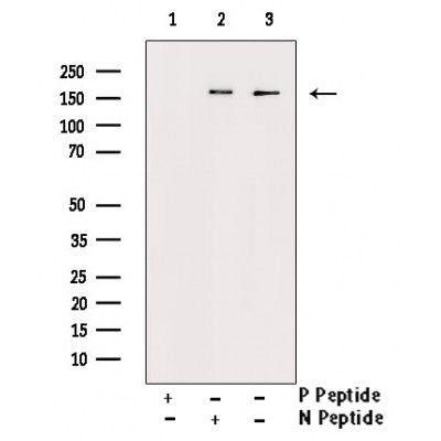 AF3127 staining HeLa cells by ICC/IF. Cells were fixed with PFA and permeabilized in 0.1% saponin prior to blocking in 10% serum for 45 minutes at 37¡ãC. The primary antibody was diluted 1/400 and incubated with the sample for 1 hour at 37¡ãC. A  Alexa Fluor? 594 conjugated goat polyclonal to rabbit IgG (H+L), diluted 1/600 was used as secondary antibod