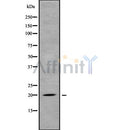 Western blot analysis of extracts from Rat liver, using MED30 Antibody. The lane on the left was treated with blocking peptide.