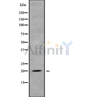 Western blot analysis of extracts from Rat liver, using MED30 Antibody. The lane on the left was treated with blocking peptide.