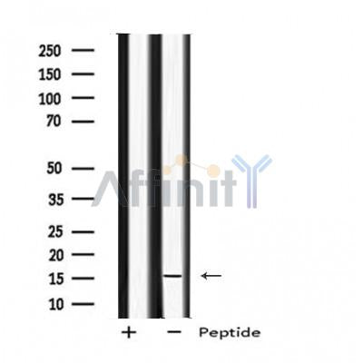 Western blot analysis of MED9 using Jurkat whole cell lysates