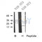 DF9621 at 1/100 staining Mouse testis tissue by IHC-P. The sample was formaldehyde fixed and a heat mediated antigen retrieval step in citrate buffer was performed. The sample was then blocked and incubated with the antibody for 1.5 hours at 22¡ãC. An HRP conjugated goat anti-rabbit antibody was used as the secondary