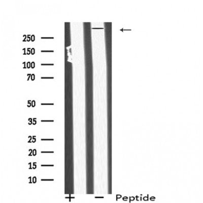 Western blot analysis of MIA3 using Jurkat whole cell lysates