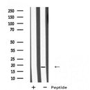Western blot analysis of extracts from 3t3, using MID1IP1 Antibody. The lane on the left was treated with blocking peptide.