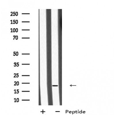 Western blot analysis of extracts from 3t3, using MID1IP1 Antibody. The lane on the left was treated with blocking peptide.