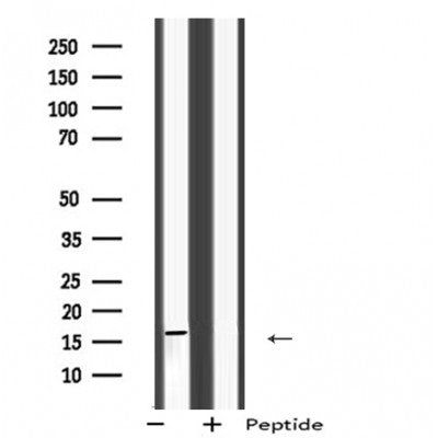 Western blot analysis of MRPS28 using HepG2 whole cell lysates