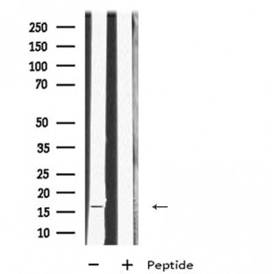 Western blot analysis of extracts from hybridoma cells, using MRPL23 Antibody. Lane 1 was treated with the blocking peptide.