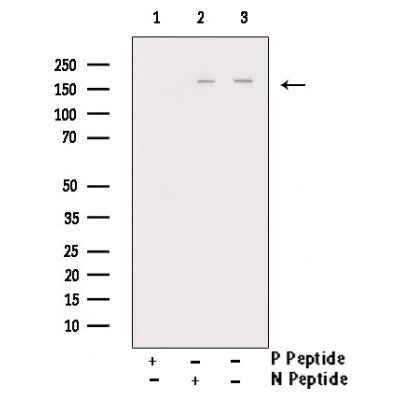 AF3128 staining A431 cells by ICC/IF. Cells were fixed with PFA and permeabilized in 0.1% saponin prior to blocking in 10% serum for 45 minutes at 37¡ãC. The primary antibody was diluted 1/400 and incubated with the sample for 1 hour at 37¡ãC. A  Alexa Fluor? 594 conjugated goat polyclonal to rabbit IgG (H+L), diluted 1/600 was used as secondary antibod