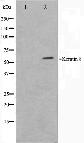Western blot analysis on 293 cell lysate using Keratin 8 Antibody. The lane on the left is treated with the antigen-specific peptide.