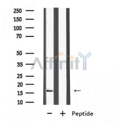 Western blot analysis of MRPL27 using HuvEc whole cell lysates