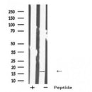 Western blot analysis IMMP1L using 293 whole cell lysates