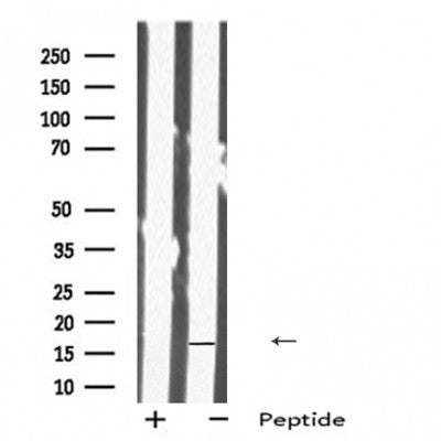 Western blot analysis IMMP1L using 293 whole cell lysates