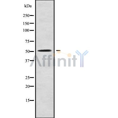 DF9631 at 1/100 staining Mouse kidney tissue by IHC-P. The sample was formaldehyde fixed and a heat mediated antigen retrieval step in citrate buffer was performed. The sample was then blocked and incubated with the antibody for 1.5 hours at 22¡ãC. An HRP conjugated goat anti-rabbit antibody was used as the secondary