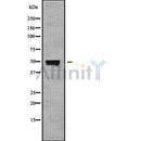 Western blot analysis of extracts from hybridoma cells, using MOT11 Antibody. Lane 1 was treated with the blocking peptide.