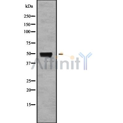 Western blot analysis of extracts from hybridoma cells, using MOT11 Antibody. Lane 1 was treated with the blocking peptide.