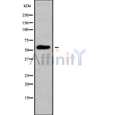 Western blot analysis of extracts from mouse brain, using MOT6 Antibody. Lane 1 was treated with the blocking peptide.