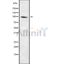 Western blot analysis of extracts from 3t3, using MPHOSPH8 Antibody. The lane on the left was treated with blocking peptide.