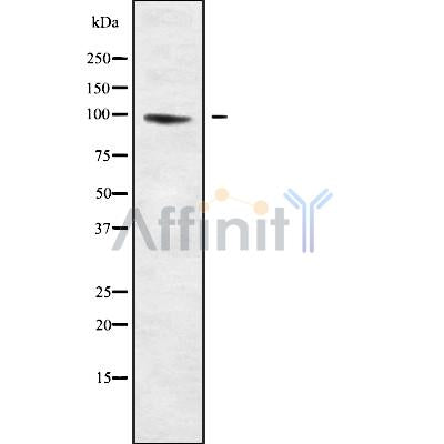 Western blot analysis of extracts from 3t3, using MPHOSPH8 Antibody. The lane on the left was treated with blocking peptide.
