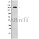 DF9643 at 1/100 staining Mouse liver tissue by IHC-P. The sample was formaldehyde fixed and a heat mediated antigen retrieval step in citrate buffer was performed. The sample was then blocked and incubated with the antibody for 1.5 hours at 22¡ãC. An HRP conjugated goat anti-rabbit antibody was used as the secondary