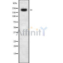 Western blot analysis of extracts from Hela, using MYO5C Antibody. Lane 1 was treated with the blocking peptide.